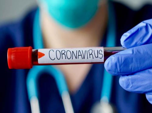 AGGIORNAMENTO PERMANENTEVIA WEB 

Coronavirus in Italia: stato dell'arte e previsioni per le prossime settimane
